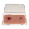 Wundmoulage mit Blutungsfunktion
