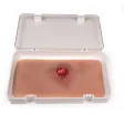 Wundmoulage mit Blutungsfunktion